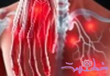 دشمن روماتیسم، راهنمای شناخت علائم و انتخاب بهترین دکتر روماتیسم