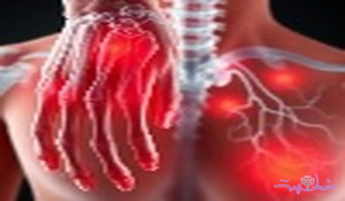 دشمن روماتیسم، راهنمای شناخت علائم و انتخاب بهترین دکتر روماتیسم