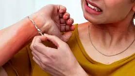 رابطه حساسیت به فلزات با کاهش اعتماد به نفس/ چگونه با این چالش‌ها کنار بیاییم؟