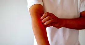 استرس چگونه باعث خارش پوست می‌شود و چگونه از آن پیشگیری کنیم؟