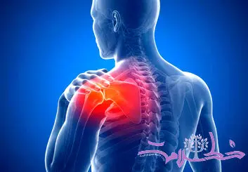 شانه منجمد چیست؟ علل، علائم و بهترین روش های درمان