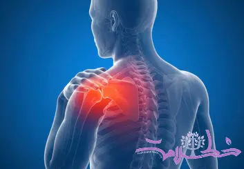 شانه منجمد چیست؟ علل، علائم و بهترین روش های درمان