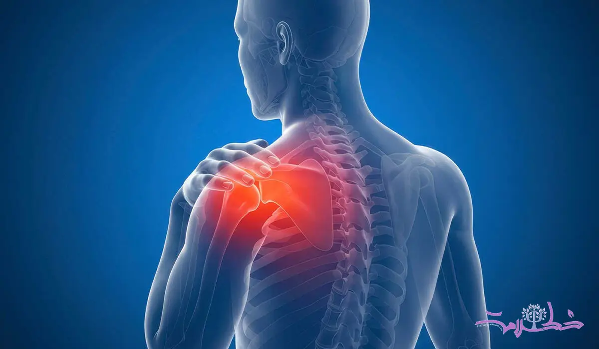 شانه منجمد چیست؟ علل، علائم و بهترین روش های درمان