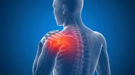 شانه منجمد چیست؟ علل، علائم و بهترین روش های درمان