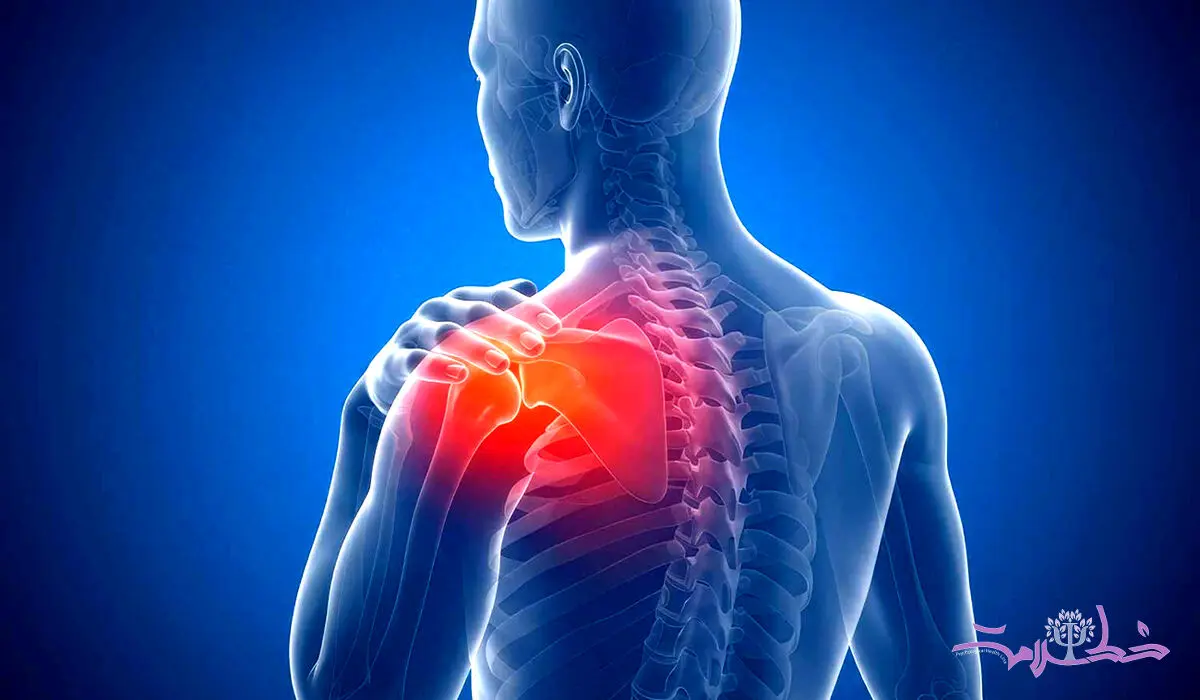 شانه منجمد چیست؟ علل، علائم و بهترین روش های درمان