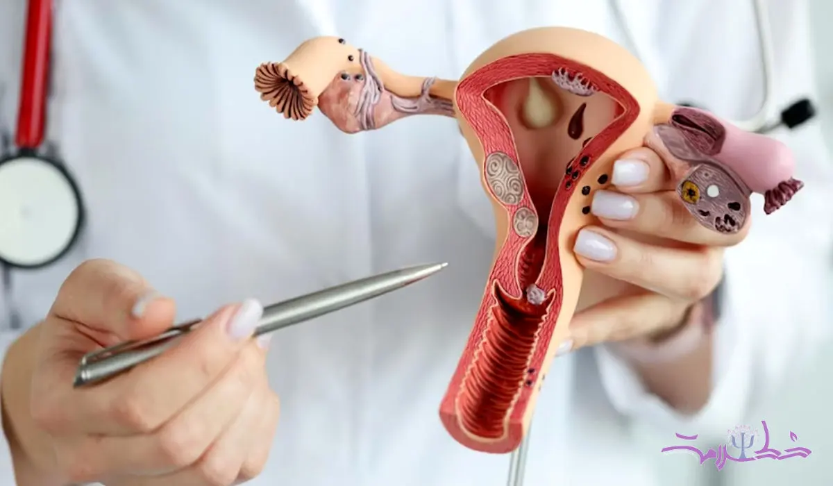 چه زمانی باردار شوید سرطان تخمدان نمی گیرید؟