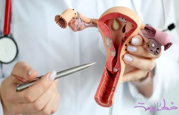 چه زمانی باردار شوید سرطان تخمدان نمی گیرید؟