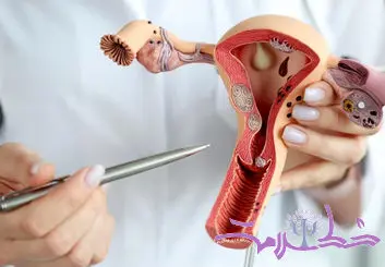 چه زمانی باردار شوید سرطان تخمدان نمی گیرید؟