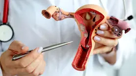 چه زمانی باردار شوید سرطان تخمدان نمی گیرید؟