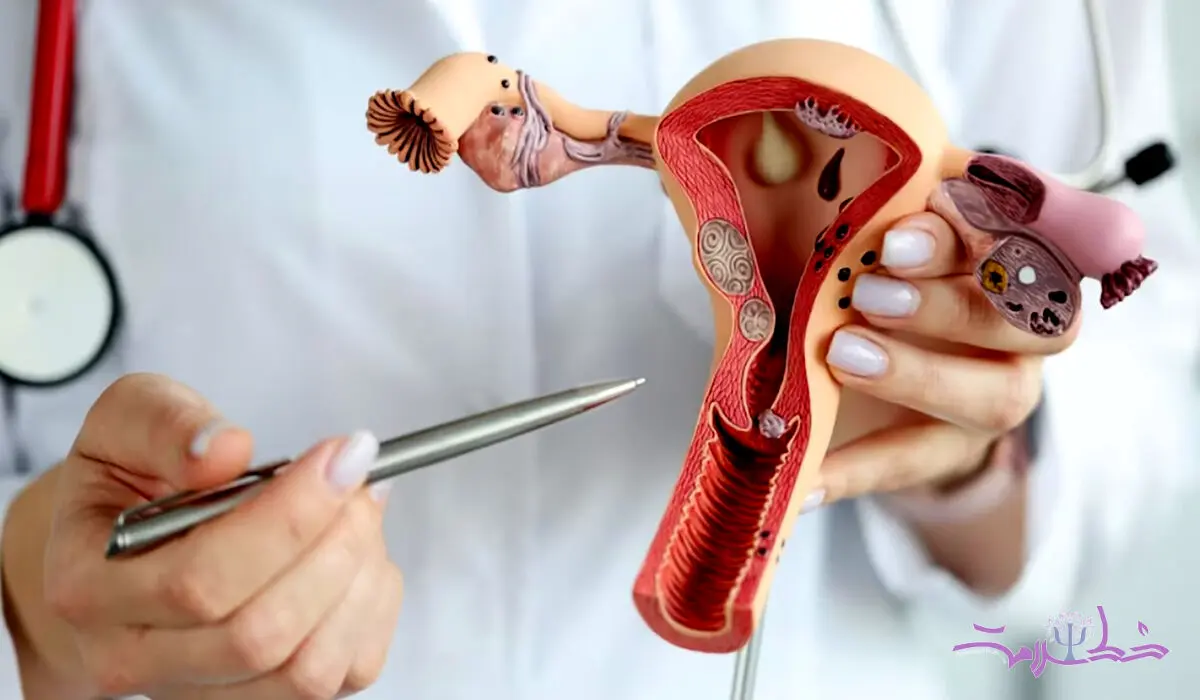 چه زمانی باردار شوید سرطان تخمدان نمی گیرید؟