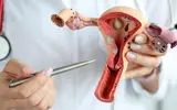چه زمانی باردار شوید سرطان تخمدان نمی گیرید؟