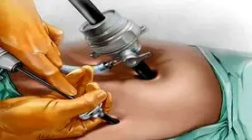 جزییات مرگ دانشجوی مهندسی در اتاق عمل/ دختر۱۴۰ کیلویی چطور جان باخت؟