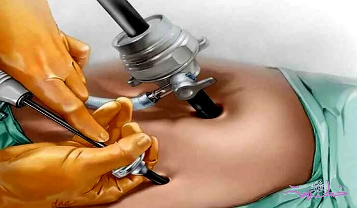 جزییات مرگ دانشجوی مهندسی در اتاق عمل/ دختر۱۴۰ کیلویی چطور جان باخت؟