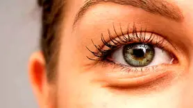 بهترین راهکارهای رفع پف زیر چشم + این 7 شیوه معجزه می کند!