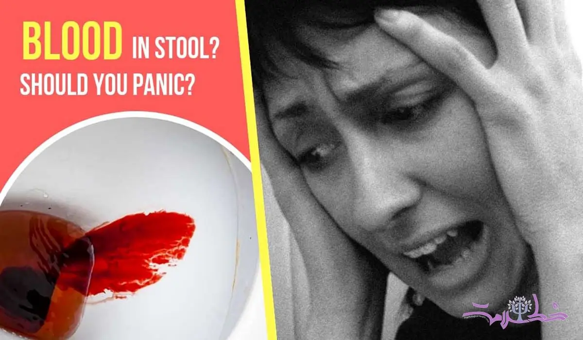 خونریزی از مدفوع و تاثیر آن بر اضطراب، افسردگی و خستگی ذهنی