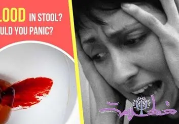 خونریزی از مدفوع و تاثیر آن بر اضطراب، افسردگی و خستگی ذهنی