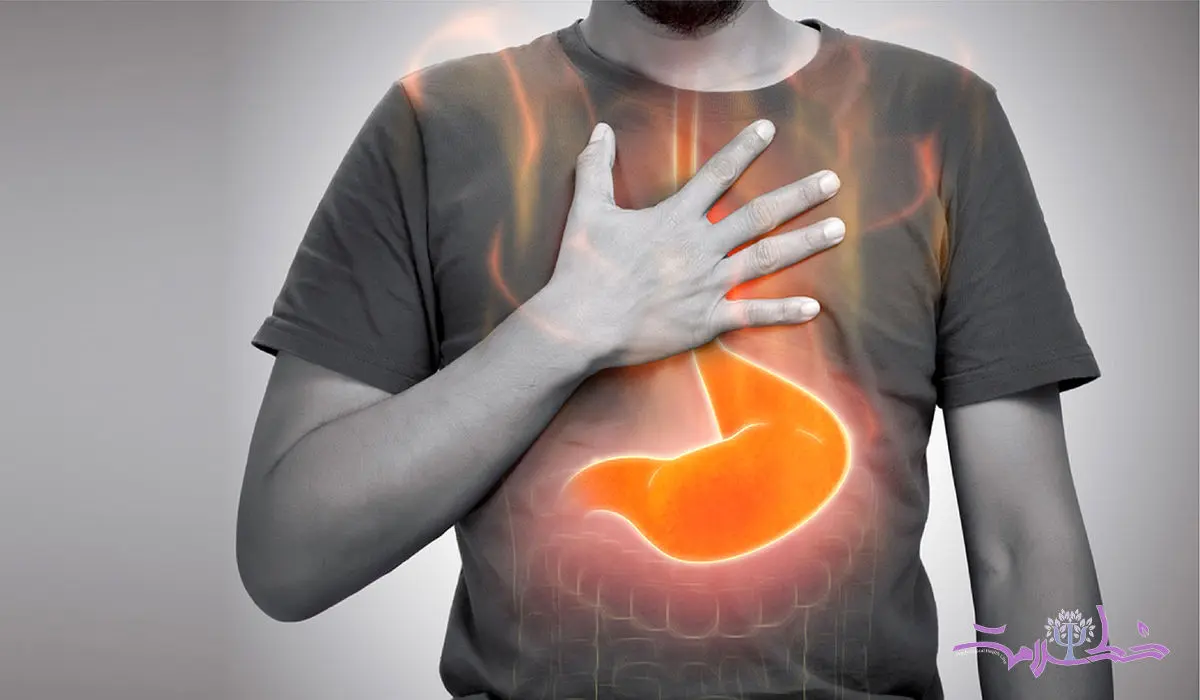 5 روش فوری برای جلوگیری از سوزش معده و «ترش کردن» 