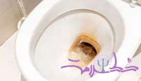 چگونه لکه‌های زرد و سمج توالت را سریع از بین ببریم؟