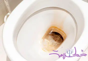چگونه لکه‌های زرد و سمج توالت را سریع از بین ببریم؟