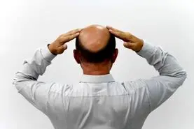 روشی جدید و طبیعی برای داشتن موهای پرپشت!