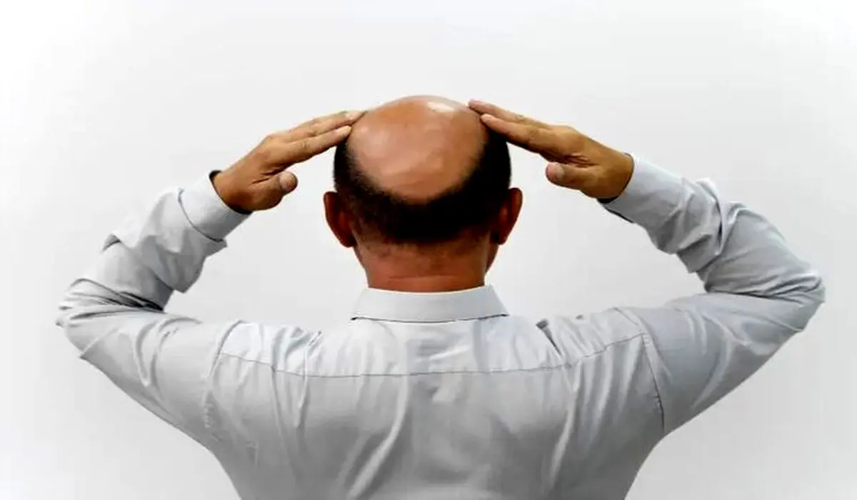 روشی جدید و طبیعی برای داشتن موهای پرپشت!