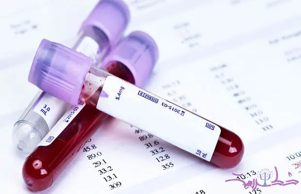 این شش آزمایش خون را چرا باید انجام دهید؟