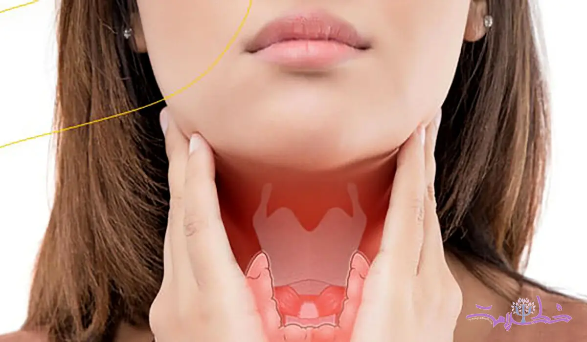 علائم مشترک سندرم تخمدان پلی کیستیک (PCOS) و کم‌کاری تیروئید برای تشخیص درست