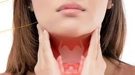 علائم مشترک سندرم تخمدان پلی کیستیک (PCOS) و کم‌کاری تیروئید برای تشخیص درست
