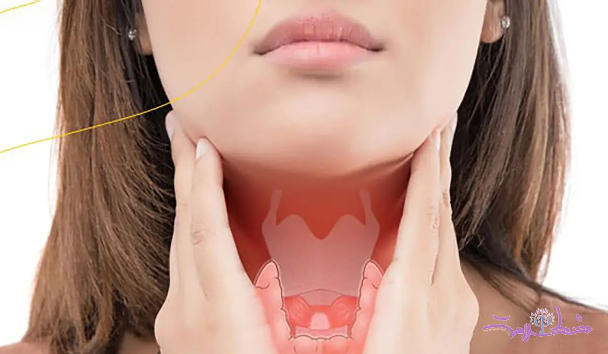 علائم مشترک سندرم تخمدان پلی کیستیک (PCOS) و کم‌کاری تیروئید برای تشخیص درست