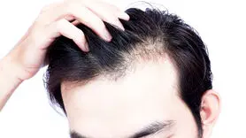 بیوتین به رشد مو کمک می‌کند