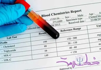 HDL در آزمایش خون نشانه چیست؟ + سطح مطلوب برای زنان و مردان