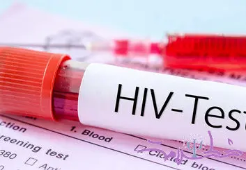 قربانی ایدز ( HIV ) نباشید/ این بیماری افزایش یافته است