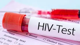 قربانی ایدز ( HIV ) نباشید/ این بیماری افزایش یافته است