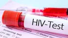 قربانی ایدز ( HIV ) نباشید/ این بیماری افزایش یافته است