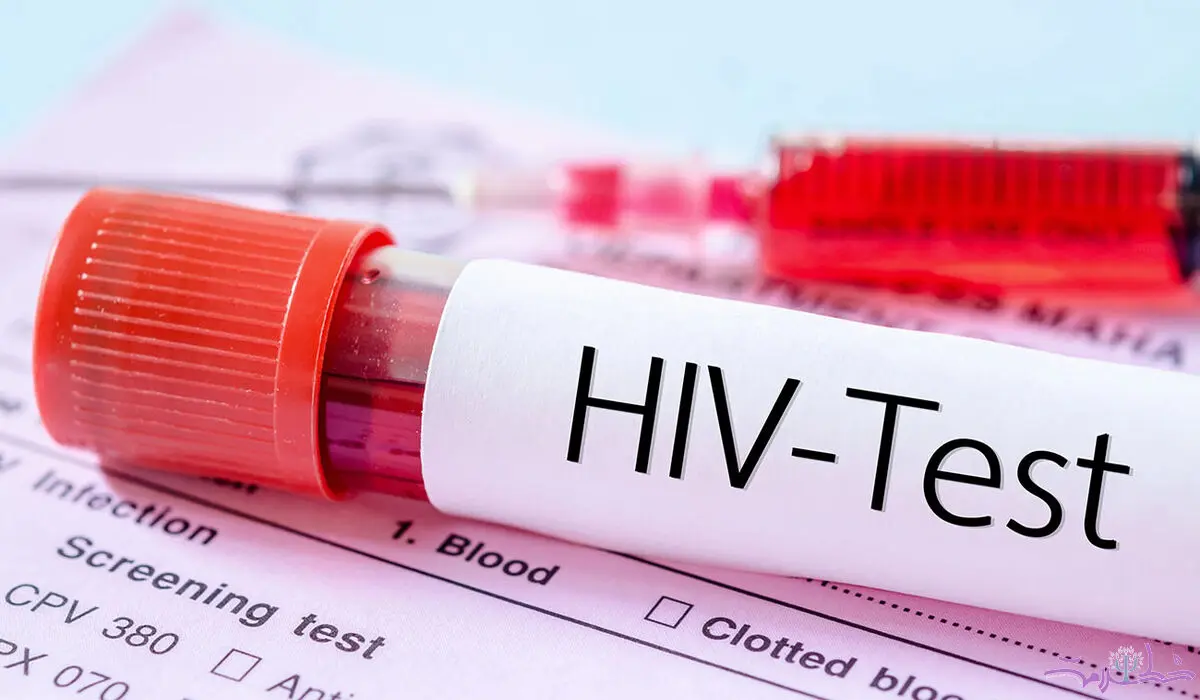 قربانی ایدز ( HIV ) نباشید/ این بیماری افزایش یافته است