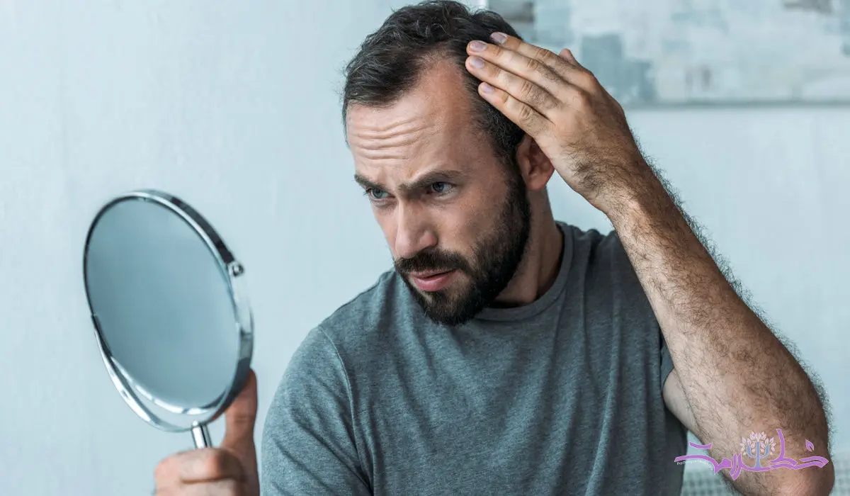 6 ویتامین که کمبودش عامل ریزش موها می شود