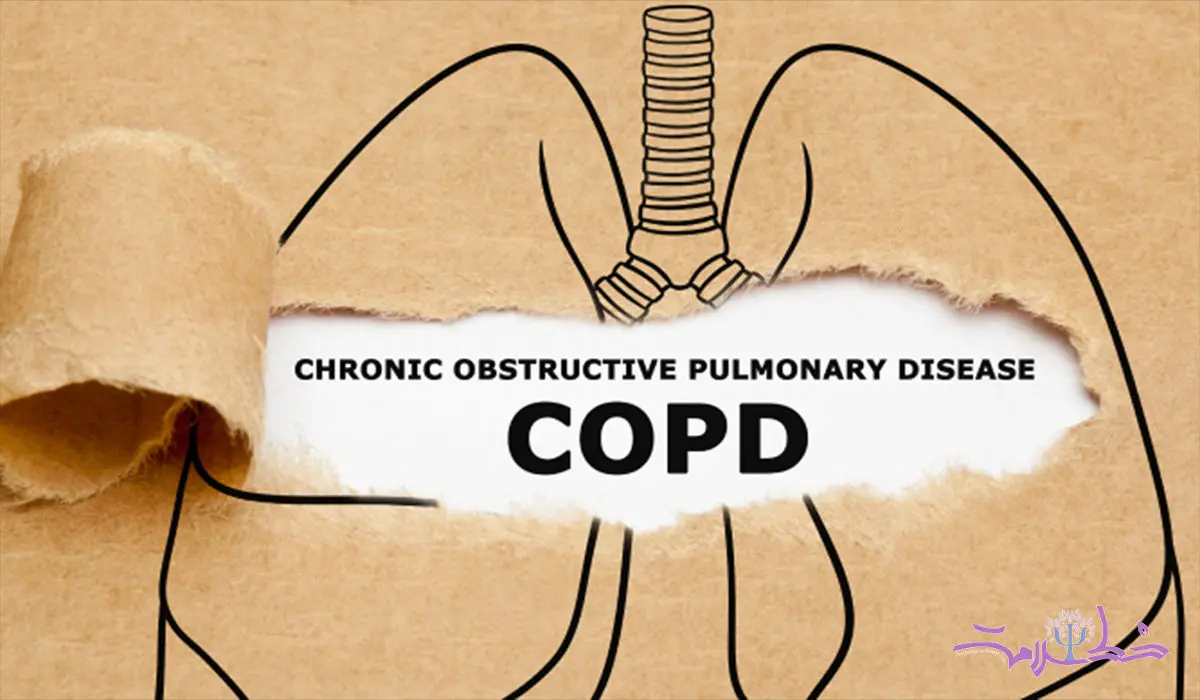 علایم بیماری انسدادی مزمن ریه (COPD) + روش های درمان