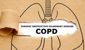 علایم بیماری انسدادی مزمن ریه (COPD) + روش های درمان
