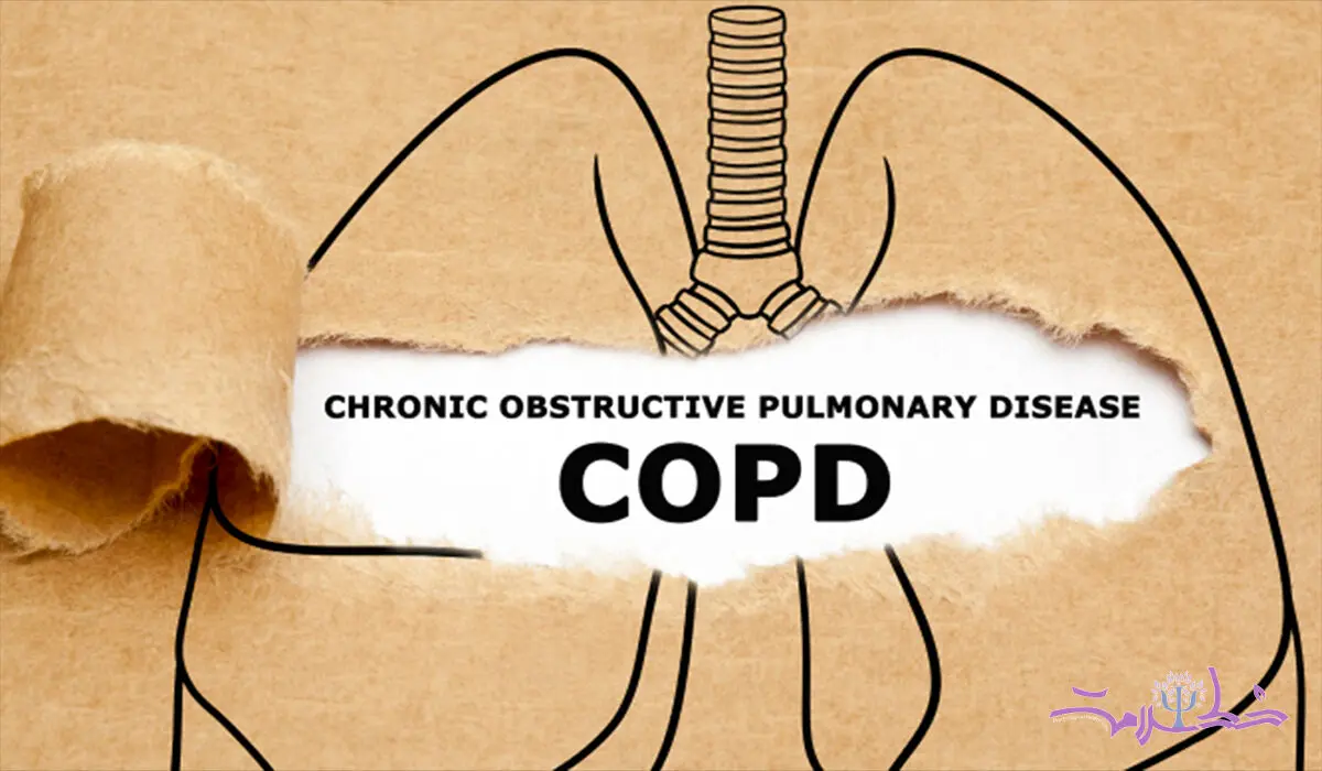 علایم بیماری انسدادی مزمن ریه (COPD) + روش های درمان