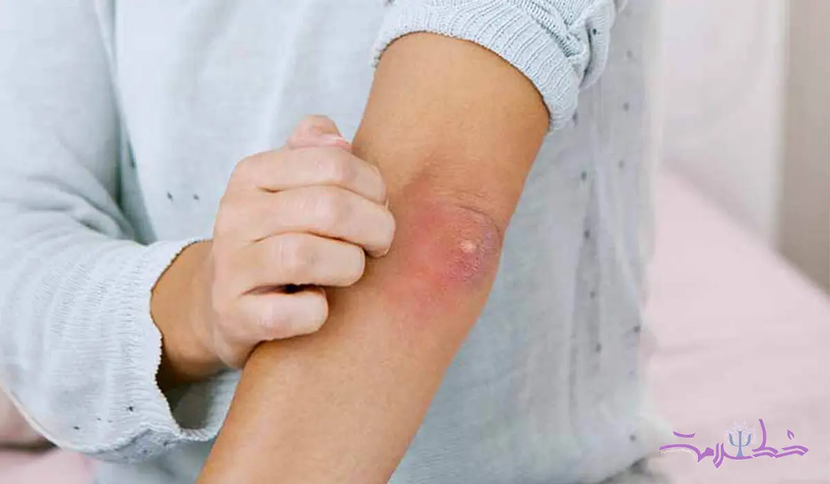 علت کندی بهبود زخم  ها چیست؟