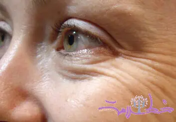 سه اشتباه بزرگ زنان که باعث چین و چروک پوست می شود!