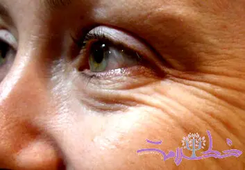 سه اشتباه بزرگ زنان که باعث چین و چروک پوست می شود!