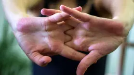 قانون وولف چیست و چگونه به تقویت استخوان ها کمک می کند؟