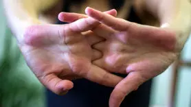 قانون وولف چیست و چگونه به تقویت استخوان ها کمک می کند؟