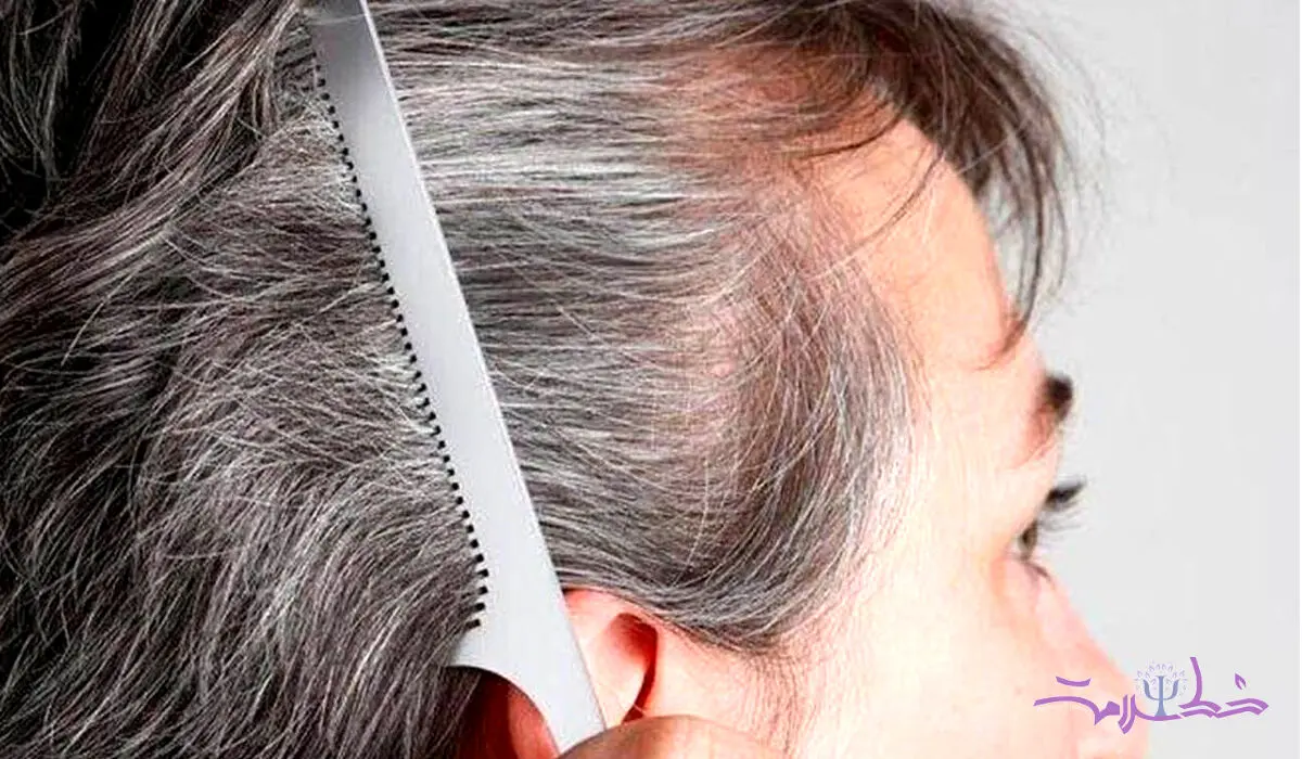 4 دلیل اصلی برای سفید شدن موها + یک خبر خوب