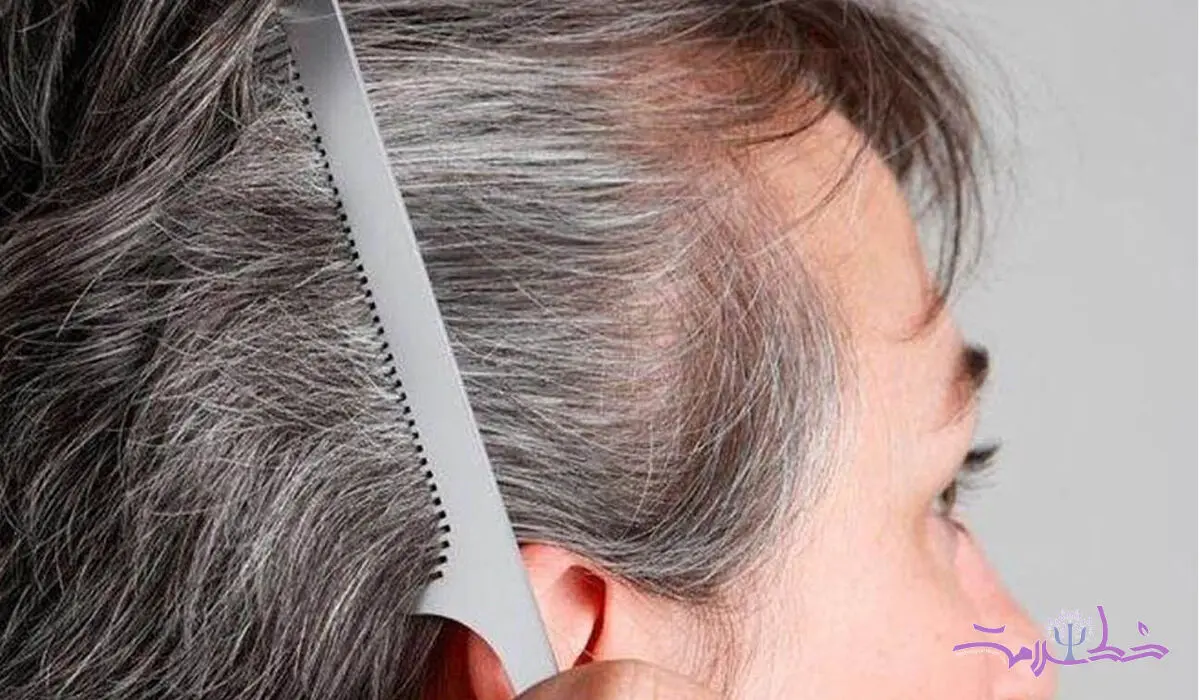 4 دلیل اصلی برای سفید شدن موها + یک خبر خوب