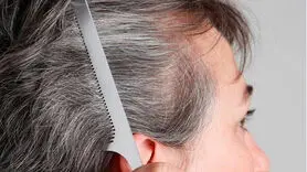 4 دلیل اصلی برای سفید شدن موها + یک خبر خوب