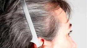 4 دلیل اصلی برای سفید شدن موها + یک خبر خوب