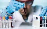 بهترین نوشیدنی برای کاهش کلسترول و چربی خون 