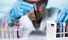 بهترین نوشیدنی برای کاهش کلسترول و چربی خون 